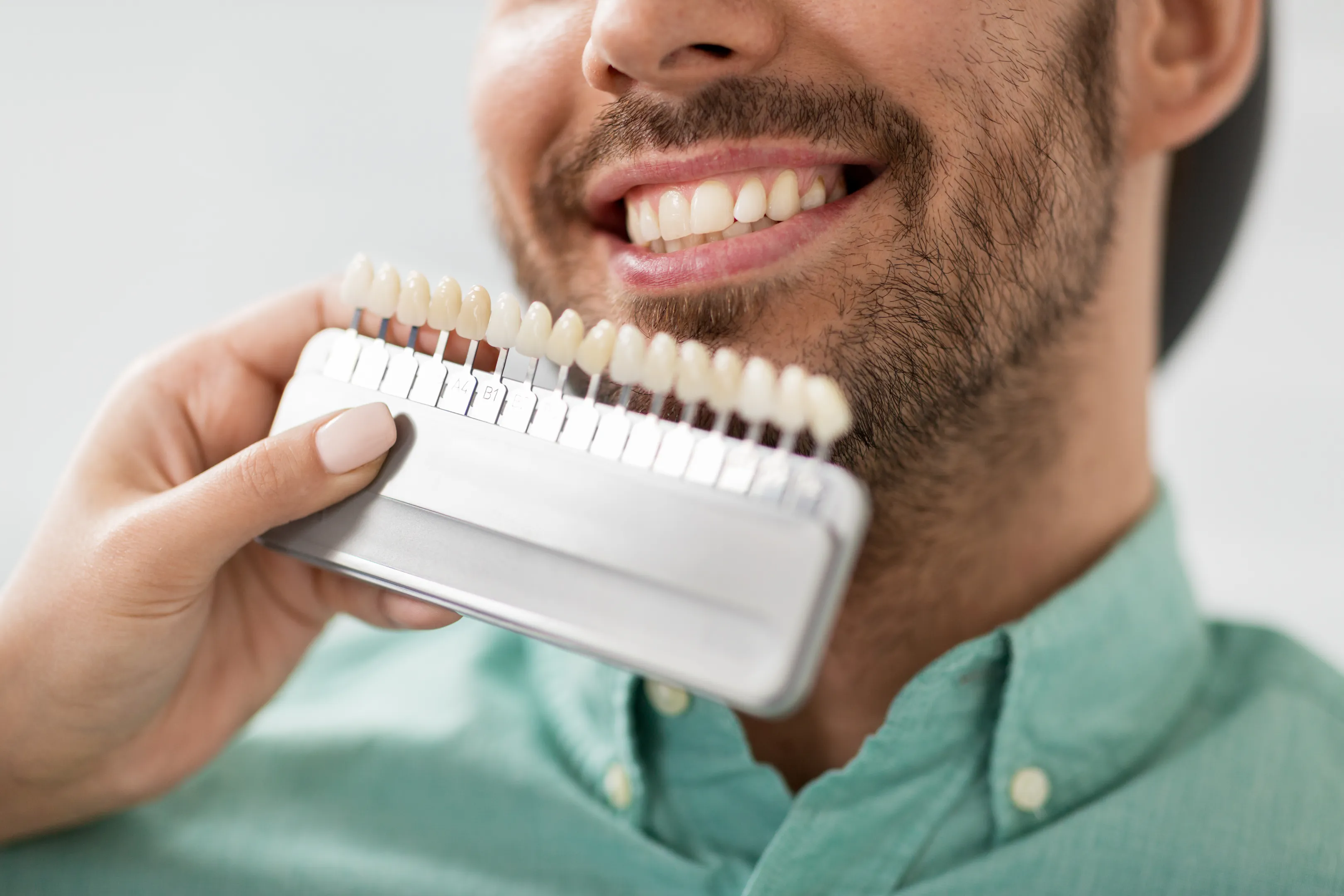 Cosmetic Dentistry Guidance: Veneers, Whitening & Smile Makeovers