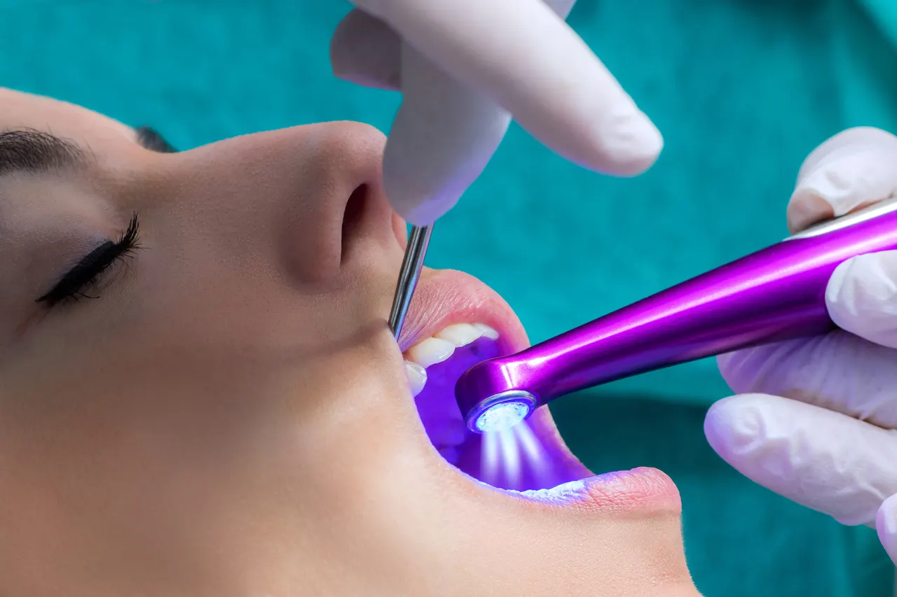 Sealants in Decatur GA at Signature Smiles Studio
